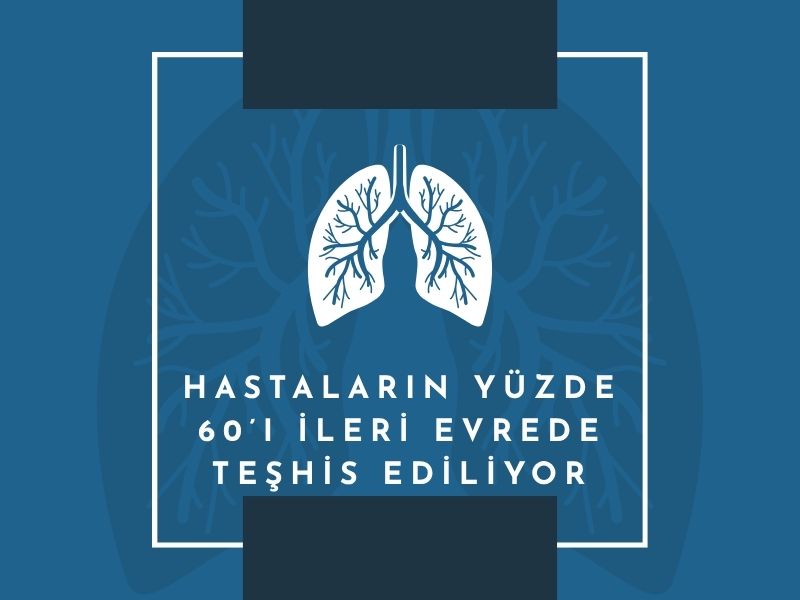 akciğer