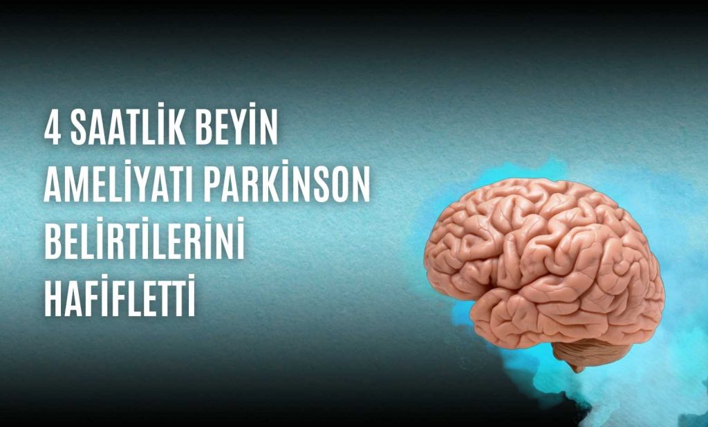 4 Saatlik Beyin Ameliyatı Parkinson Belirtilerini Hafifletti
