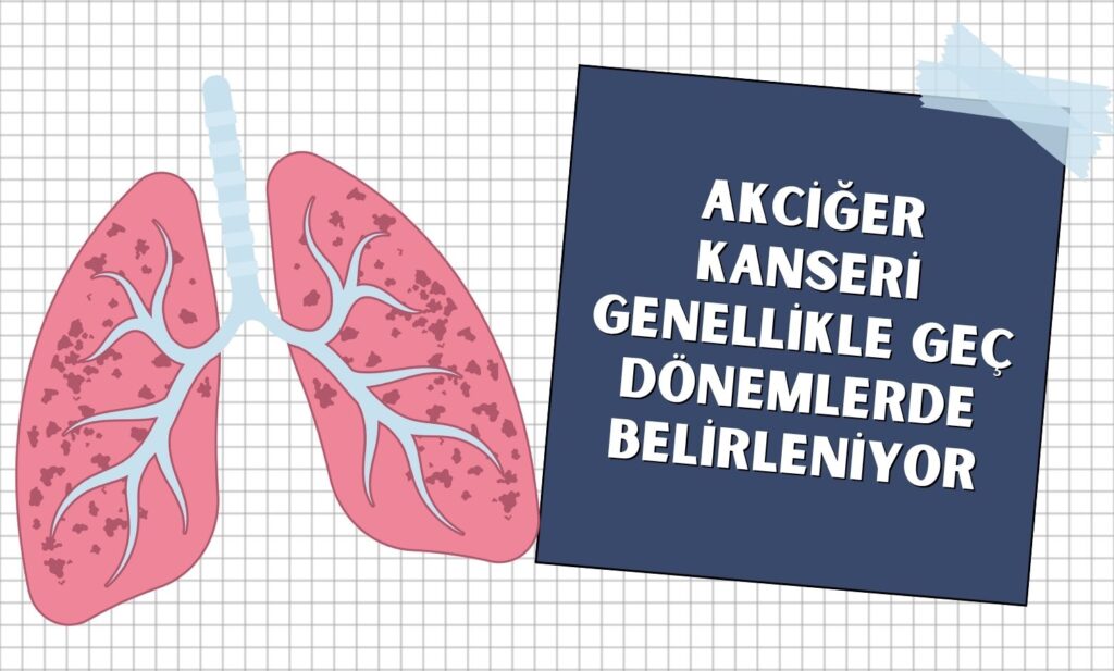 Akciğer Kanseri Genellikle Geç Dönemlerde Belirleniyor