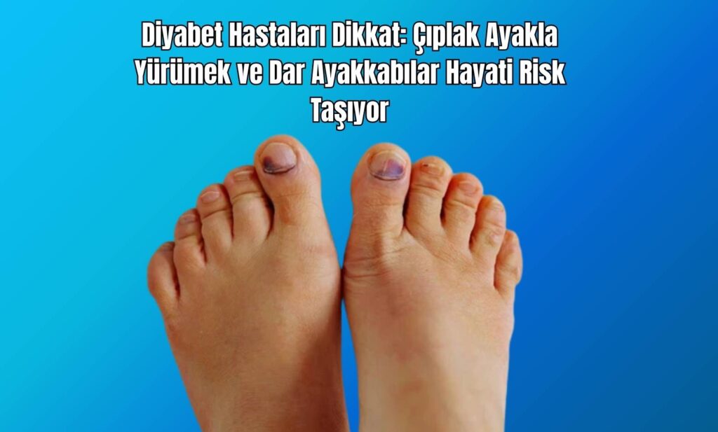Diyabet Hastaları Dikkat: Çıplak Ayakla Yürümek ve Dar Ayakkabılar Hayati Risk Taşıyor