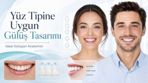 Yüz Tipine Uygun Gülüş Tasarımı Nasıl Belirlenir İdeal Gülüşün Anatomisi